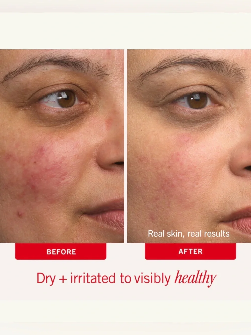 First Aid Beauty Ultra Repair Cream - Pale Blue Jar with Red Text